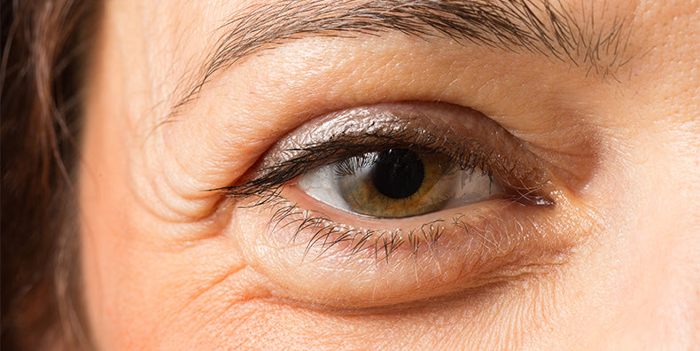 Say Buh Bye To Tired Eyes 12 Eye Treatments That Actually Work