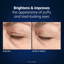 PCA Skin Hyaluronic Acid Microneedle Eye Patches