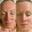 Epicutis Lipid Recovery Mask