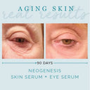 Neogenesis Eye Serum